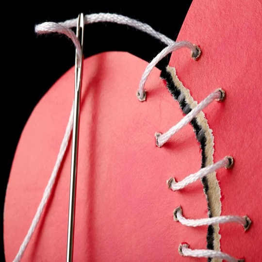 Himenoplasti Himenoplasti