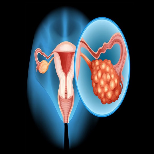 Gebärmutteranomalien