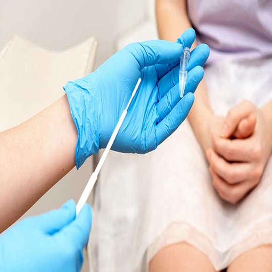 Smear Testi Smear Testi