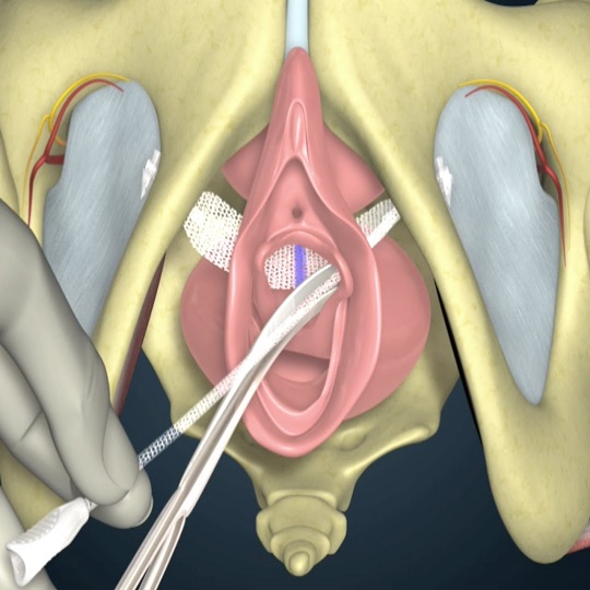 Vaginale Anwendungen