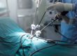 Laparoskopi ile hangi ameliyatlar yapılabilir?